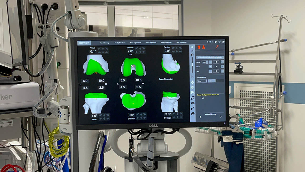 Vous recherchez le meilleur chirurgien orthopédique de Marseille ? Le robot chirurgical Mako est un exemple de technologie de pointe qui peut améliorer significativement les résultats votre opération.