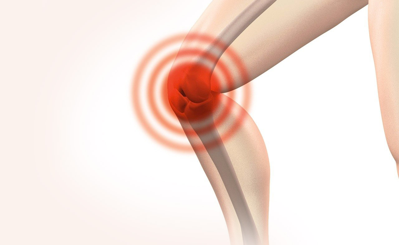 Explications sur l'anatomie du genou et de la hanche. Image par naturwohl-gesundheit de Pixabay.